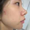 에이 플러스 | 모공탄력 잡는 바쿠치올세럼 추천｜덤에이플러스 프리미엄 3X 엑소좀 세럼 리얼 사용 후기