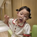 [영등포 김안과] 소아 간헐적 외 사시 수술 후기/비용