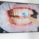 서울온정치과의원 이미지