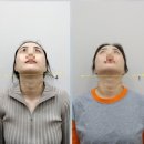 온마음한의원 | 안면비대칭교정한의원 찾아 천호역에서 교정받고 온 후기