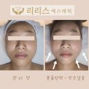 리리스 에스테틱 | 역삼동 피부관리 탄력관리와 윤곽관리 한번에 리리스 에스테틱