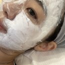 사라피부 | 신논현역피부과 리쥬란 효과로 속건조피부 탈출 후기