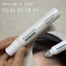 딜 | M자 이마의 탈모 앰플 일주일 사용 후기 | 판토딜 포 헤어 앰플