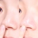 올리브영 일소 코팩 추천 블랙헤드 피지제거 후기 쿨링 마사지기로 모공수렴 진정효과까지!