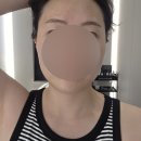 한방언니청담 | 쿨소닉, 세르프 리프팅 압구정로데오 청담 피부과에서 시술 끝나자마자 쓰는 내돈내산 후기