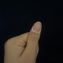 토탈솔루션 | 손톱세로줄 관리 시작 디펜턴 토탈솔루션 손톱세럼 사용 후기