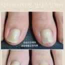 닥터아이티엔강남스킨케어 네이버블로그