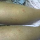 에버노블 이미지