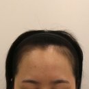 부산 맘모스헤어라인의원 이미지