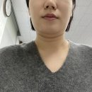 [내돈내산] 목동 인모드 이중턱 후기/ 인모드 슈링크 차이/ 인모드 fx/ 인모드 포마/ 인모드마취크림