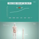 한국인 암지도 2편- 소화기암 서구형으로 변했다(생로병사의 비밀 2016-3-9) 이미지