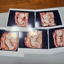 서울휴병원 이미지