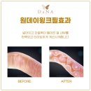 윙크볼륨 이미지