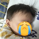 의료법인칠석의료재단사랑의병원 | 갑작스러운 아기 고열, 소아응급실 다녀온 후기 (요로감염 의심 증상 및 경기/인천 소아응급실 리스트)