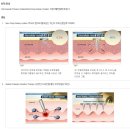닥터스칼프 신촌점 | 닥터스칼프 신촌점 M자와 정수리 탈모관리 후기입니다~^6^