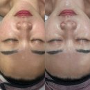 무왕로 | [익산]부송동 올가뷰티: 모공 디톡스부터 연어크림까지, 극강의 보습+리프팅 솔루션