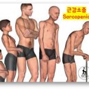 근감소증 증상 근육이 줄어들게 되면 어떤 변화가 찾아올까? 이미지