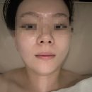 드림랜드,스타벅스 사거리(베스킨라빈스) | 청주 윤곽관리 잘하는 곳 찾는다면 강서동 “이래서에스테틱” 찐후기