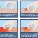피부가려움증 어떤 원인에 의해 발생하는지 궁금하다면 이미지