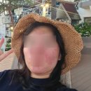 강화쑥쑥 2 | [B.쑥쑥일기] 임산부 얼굴 소양증,피부염 내돈내산 관리후기