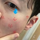 26500-74-04-051 | 또간집 피부과_부산 이현재피부과_1주차(부산 서면 피부과 가격,위치,예약방법등..)