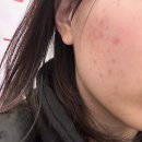 김종민피부과의원 티스토리