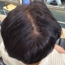 MIMO HAIR(미모헤어) | 미용실추천 구미 도량동 러블랑헤어 | 납작했던 가르마 볼륨이 봉긋 살아났어요 | 구미 모류교정펌 후기