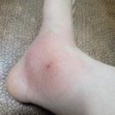 여름철 모기 알러지 대비, 캠핑 베란다 모두 가능! 굿나잇모기향 코일형 스틱형 비교 실사용 후기