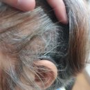 평택보청기 | 평택보청기 스타키보청기 평택센터에서 새 보청기 맞춘 상세후기!