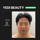 예디뷰티