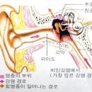 어린이 중이염 이미지