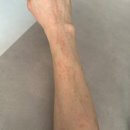 이편한뜰어린이집-1구간 | 쌍둥이임신 35주차 기록｜자궁경부길이, 태동검사, 임신 두드러기, 아주대병원 외래