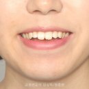 예쁜치아만들기치과의원 이미지