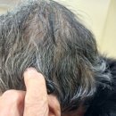 와이덱스보청기 의정부점 | 호원동보청기 할아버지 선물로 독일렉스톤보청기 의정부점 다녀온 후기