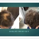 이지성형외과 이미지