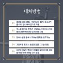 방방고 이미지