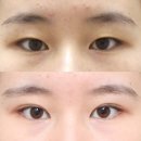 올리팅성형외과의원 이미지