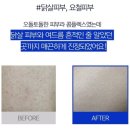 내모메는 | 모공각화증에 좋은 내모메 바디로션 사용 찐 후기