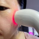 (주)차메디텍 | 듀얼소닉 맥시멈 복합성피부 3일 사용 솔직 후기 홈케어 피부관리