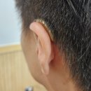 스타키보청기 이미지