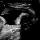 보람내과의원 이미지