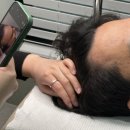 스킨N스칼프 이미지