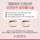 꼼꼼성형외과의원 이미지