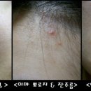 홍치마