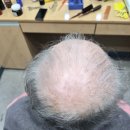 인천가발 맞춤 착용해보세요