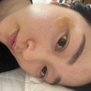 꽁이랑 | 안했음 후회했을 뻔한 흑자 리터치 후기 , 대만족흑자이야기 2탄