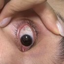 연세약국 | [수연세안과] 내돈내산 안경탈출 라섹후기 :: 박성배 원장님, 주차, 팁