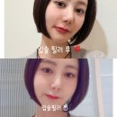 미인피부과의원 | 강남 피부과 입술 필러 후기, 입술 문신 부작용 해결하고 비엘에스의원에서 내돈내산 1차 성공!