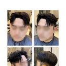 강북구 맨즈헤어샵 &#34;WIG 하이맨즈헤어&#34; 맞춤가발 후기