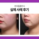 휴플러스의원 | 서대문구리프팅, 세르프 vs 실리프팅 뭐가 더 효과적일까?